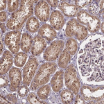 SLC35D2 Antibody, Novus Biologicals&trade;