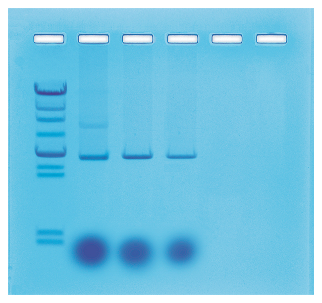Mini-Prep Isolation of Plasmid DNA