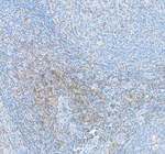 CD4 Recombinant Rabbit Monoclonal Antibody (BL-155-1C11)