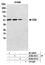 CD4 Recombinant Rabbit Monoclonal Antibody (BL-155-1C11)