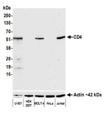 CD4 Recombinant Rabbit Monoclonal Antibody (BL-155-1C11)