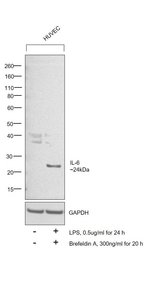 IL-6 Monoclonal Antibody (5IL6)