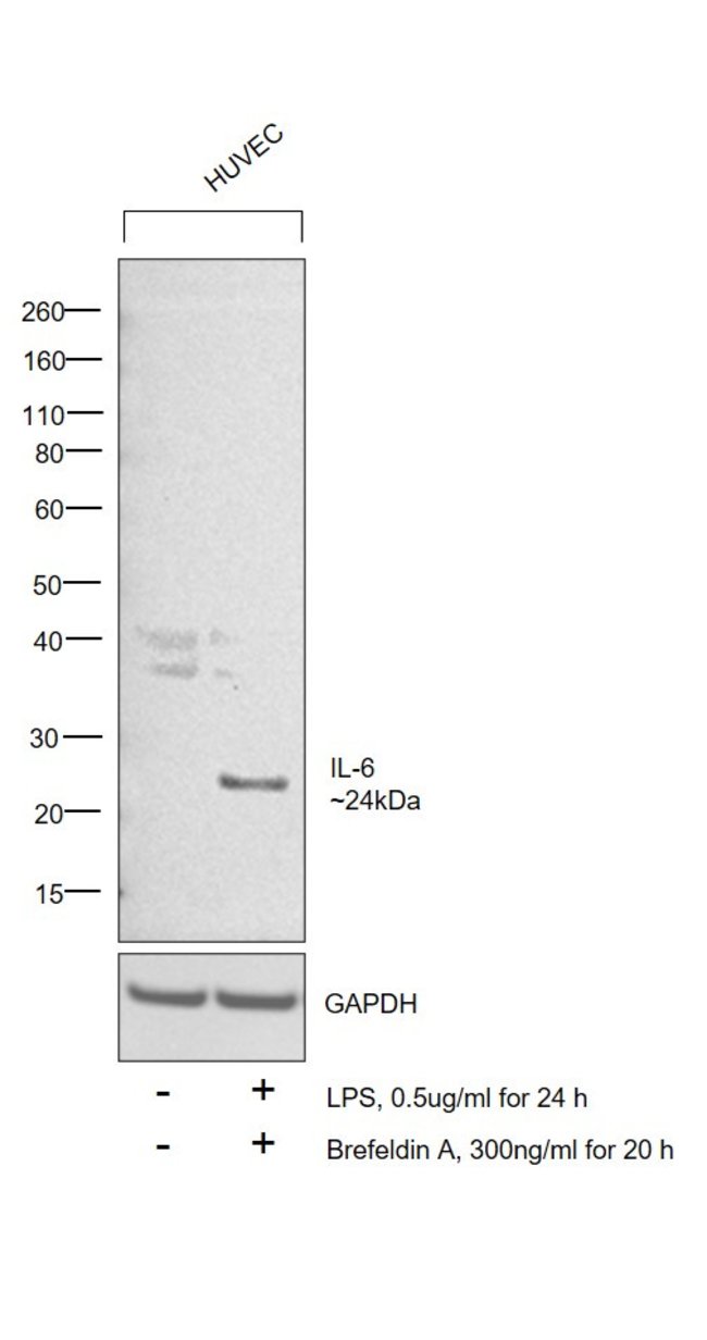 IL-6 Monoclonal Antibody (5IL6)