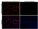 Progesterone Receptor Monoclonal Antibody (PR-AT 4.14)