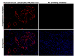 Progesterone Receptor Monoclonal Antibody (PR-AT 4.14)