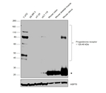 Progesterone Receptor Monoclonal Antibody (PR-AT 4.14)