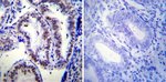 Progesterone Receptor Monoclonal Antibody (PR-AT 4.14)