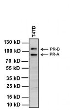 Progesterone Receptor Monoclonal Antibody (PR-AT 4.14)